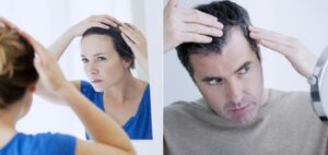 ریزش مو | هر آنچه که باید بدانید