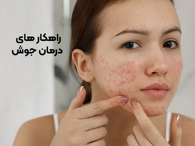 بهترین راهکارهای درمان جوش چیست