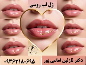 ژل لب روسی؛ رازی برای لب ‌هایی طبیعی، برجسته و ماندگار