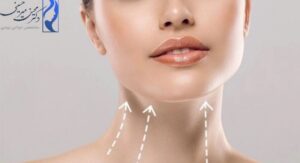 5 روش افزایش جذابیت چهره با لیپوماتیک صورت