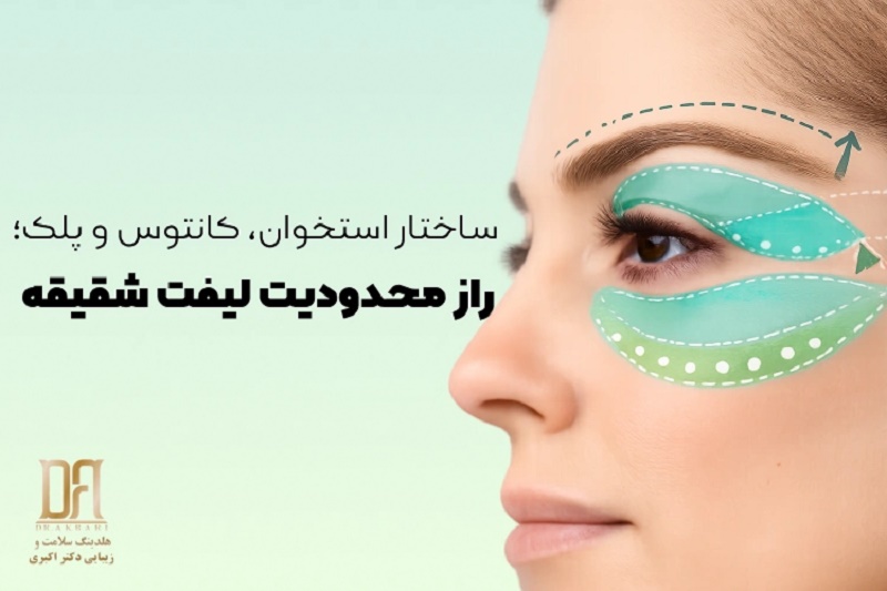 آیا لیفت شقیقه همیشه بهترین راه‌حل جوانسازی ناحیه چشم است؟
