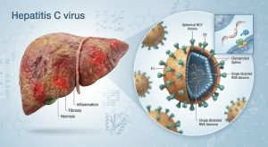 بیماری هپاتیت C | از تشخیص بیماری خاموش