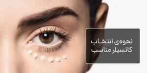 نحوه انتخاب کانسیلر مناسب چظوزه